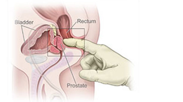 Πού είναι το "Σημείο L" στον άνδρα;