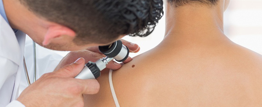 Δωρεάν δερματολογικές εξετάσεις μελανώματος στον Δήμο Ηρακλείου Αττικής
