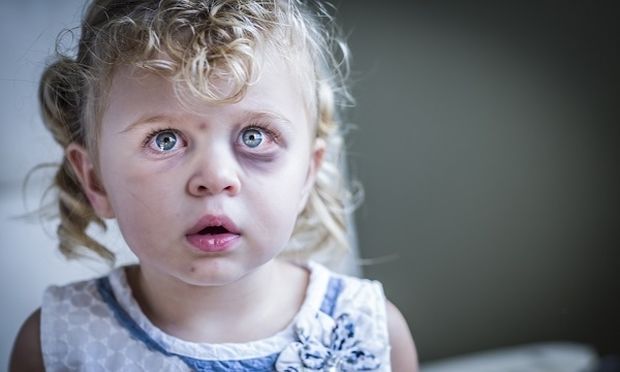 Ένα στα δύο παιδιά, θύμα σωματικής βίας…