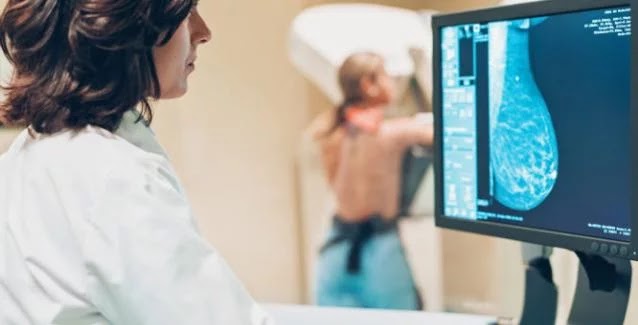 Μύθοι και αλήθειες για τη μαστογραφία