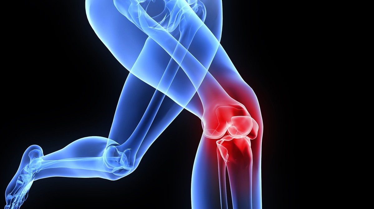 Ρήξη Χιαστού